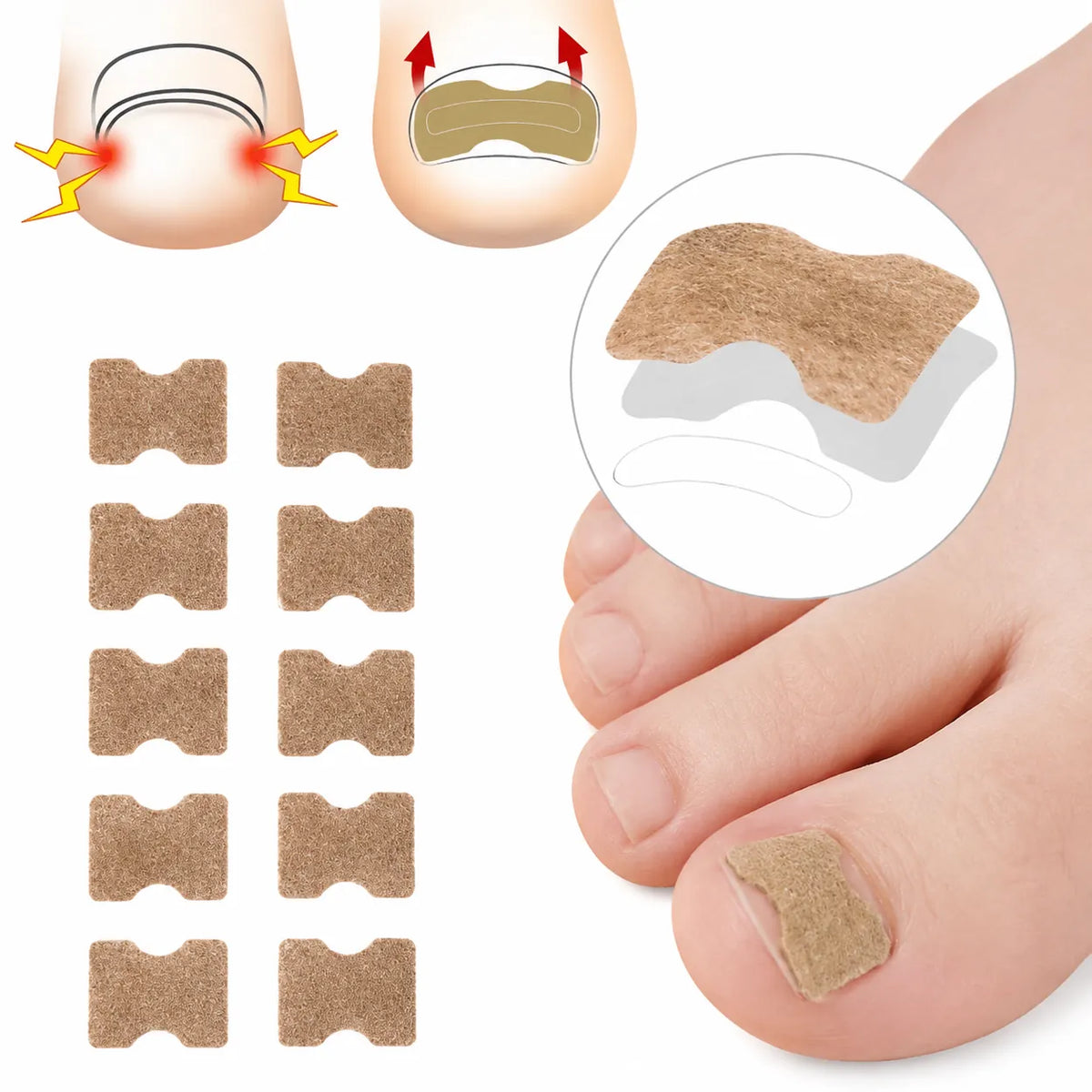 Nageltejp applicerad på stortån med illustration av tejpens placering runt nagelkanten.